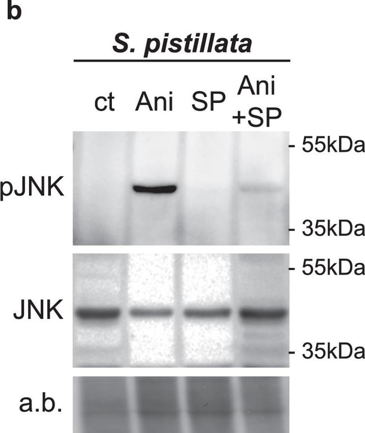 Detection of Human JNK1/2/3 by Western Blot