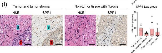 Detection of Osteopontin/OPN by Immunohistochemistry