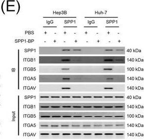 Detection of Osteopontin/OPN by Western Blot
