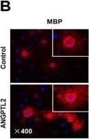 Detection of Angiopoietin-like 2 by Immunocytochemistry/ Immunofluorescence
