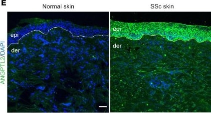 Detection of Angiopoietin-like 2 by Immunohistochemistry
