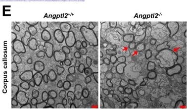 Detection of Angiopoietin-like 2 by Immunohistochemistry