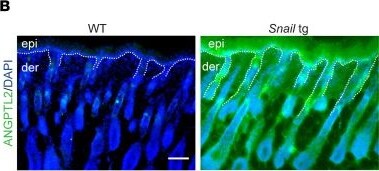 Detection of Angiopoietin-like 2 by Immunohistochemistry
