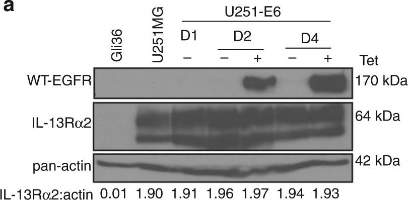 Detection of Human IL-13R alpha 2 by Western Blot
