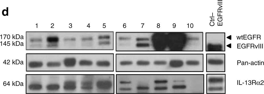 Detection of Human IL-13R alpha 2 by Western Blot
