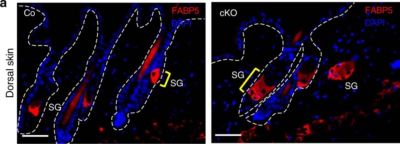 Detection of Mouse FABP5/E-FABP by Immunocytochemistry/ Immunofluorescence
