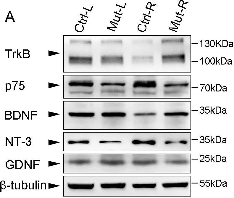 Detection of TrkB by Western Blot