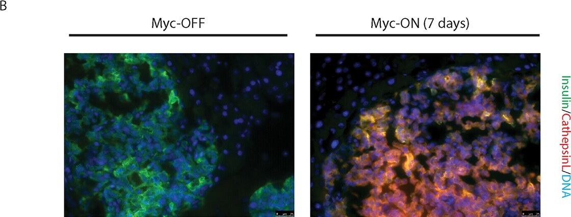 Detection of Mouse Cathepsin L by Immunocytochemistry/ Immunofluorescence