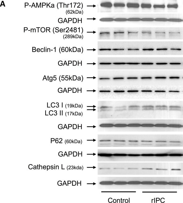 Detection of Cathepsin L by Western Blot