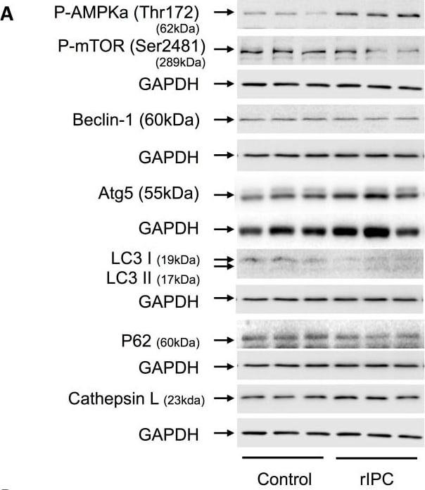 Detection of Cathepsin L by Western Blot