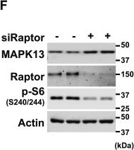 Detection of p38 delta by Western Blot