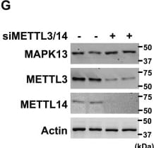 Detection of p38 delta by Western Blot