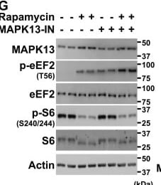 Detection of p38 delta by Western Blot