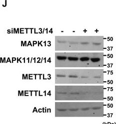 Detection of p38 delta by Western Blot