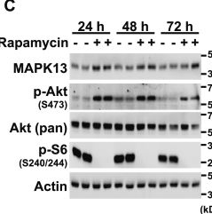 Detection of p38 delta by Western Blot