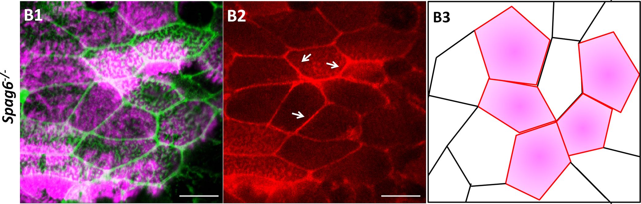 Detection of Mouse Frizzled-6 by Immunocytochemistry/Immunofluorescence