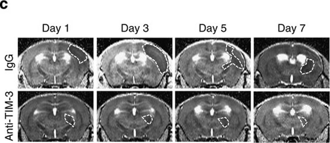 Detection of Mouse TIM-3 by Immunohistochemistry