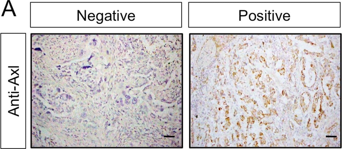 Detection of Human Axl by Immunohistochemistry