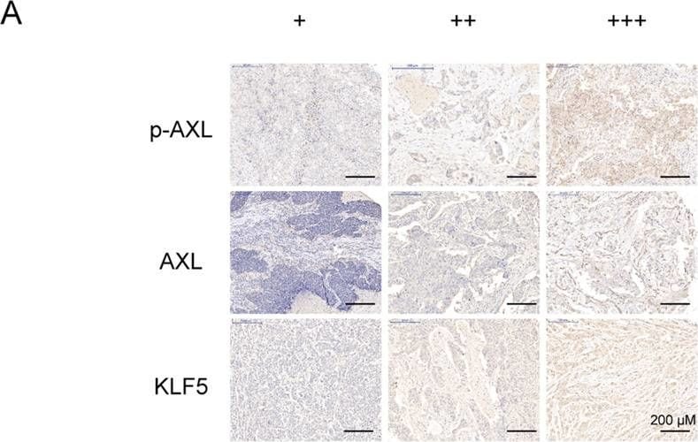 Detection of Human Axl by Immunohistochemistry
