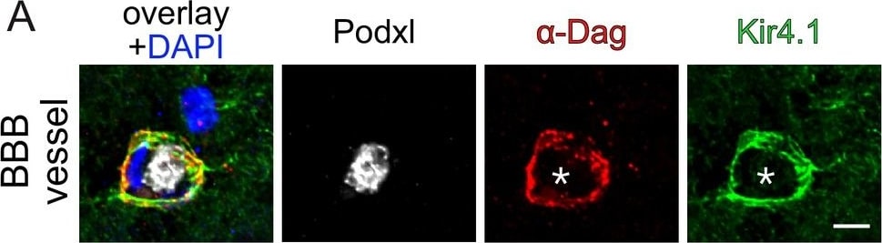 Detection of Mouse Podocalyxin Like by Immunocytochemistry/Immunofluorescence