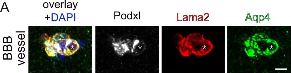 Detection of Mouse Podocalyxin Like by Immunocytochemistry/Immunofluorescence