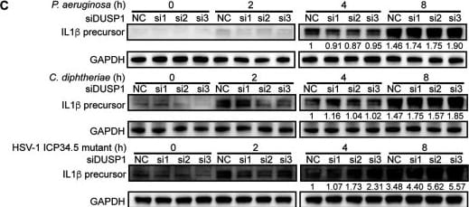 Detection of IL-1 beta /IL-1F2 by Western Blot