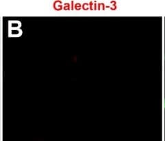 Detection of Galectin-3 by Immunocytochemistry/ Immunofluorescence