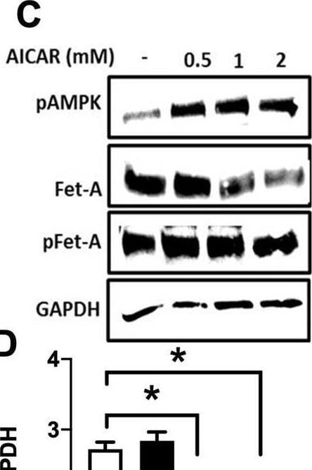 Detection of Fetuin A/AHSG by Western Blot