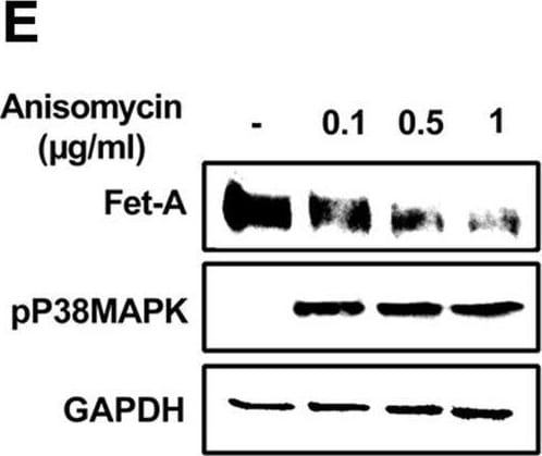 Detection of Fetuin A/AHSG by Western Blot