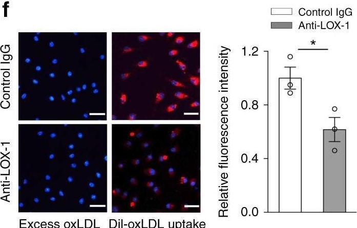 Detection of Mouse LOX-1/OLR1 by Immunocytochemistry/ Immunofluorescence