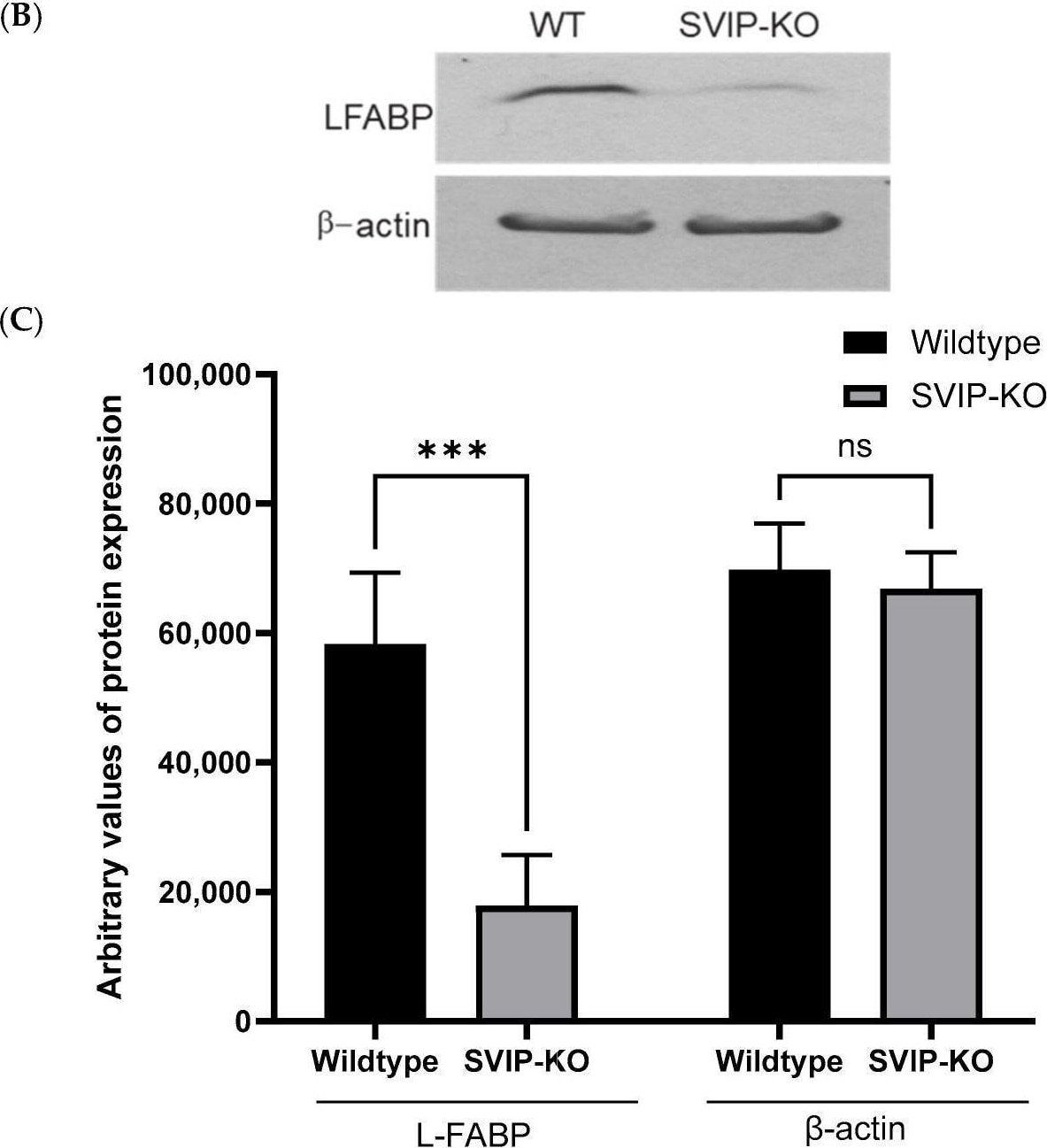 Detection of FABP1/L-FABP by Western Blot