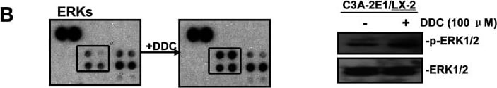 Detection of Human ERK1/ERK2 by Western Blot