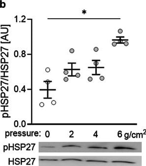 Detection of HSP27 by Western Blot