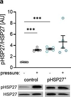 Detection of HSP27 by Western Blot
