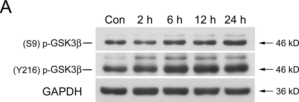 Detection of Rat GSK-3 alpha/beta by Western Blot