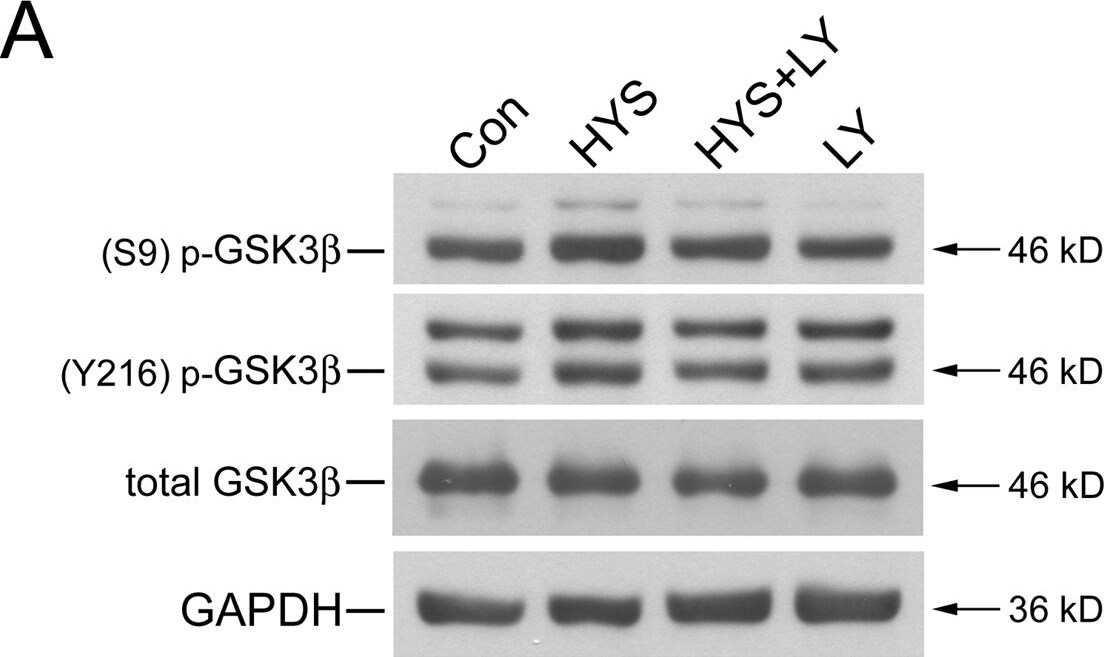 Detection of Rat GSK-3 alpha/beta by Western Blot