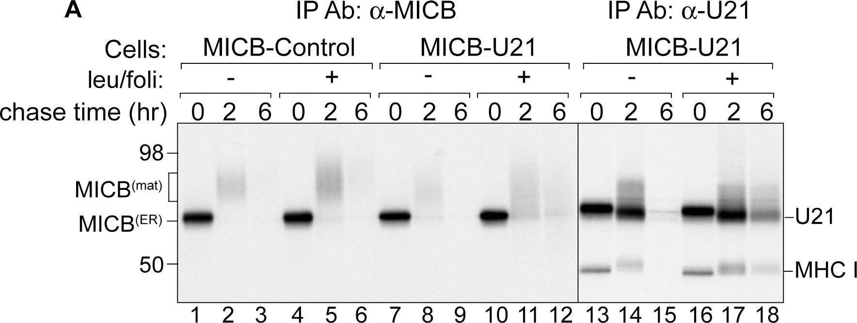 Detection of Human MICB by Western Blot