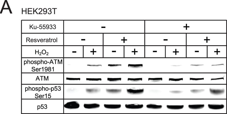 Detection of Human ATM by Western Blot
