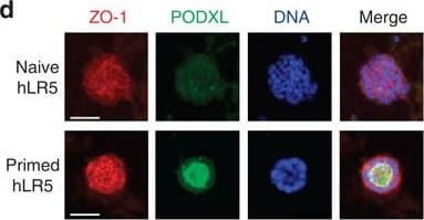 Detection of Human Podocalyxin Like by Immunocytochemistry/Immunofluorescence