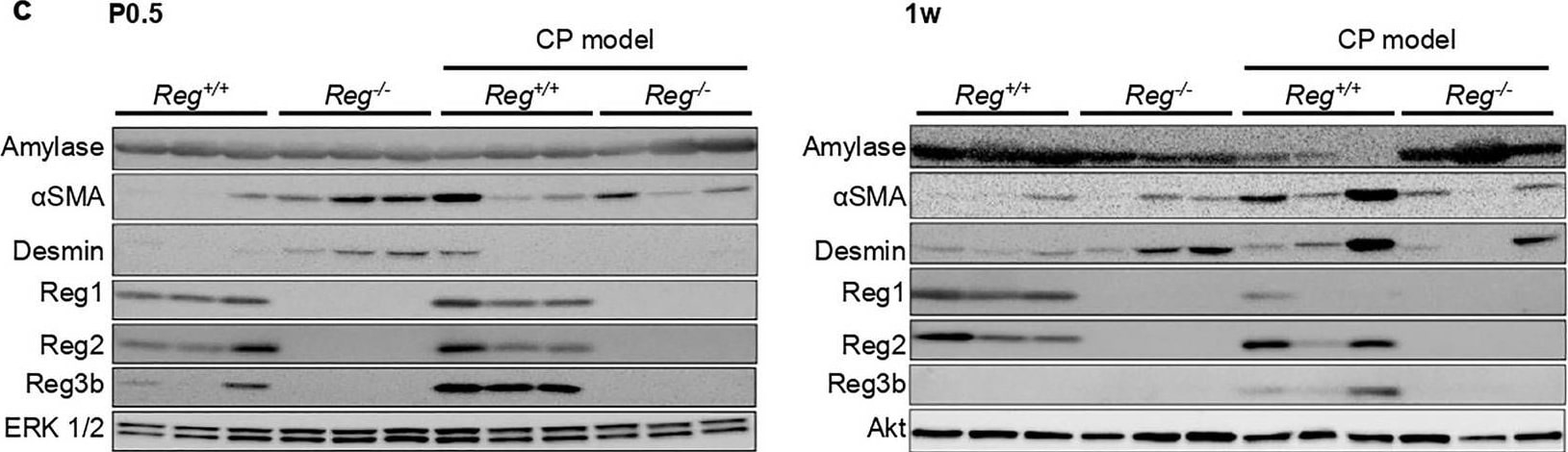 Detection of Podocalyxin by Western Blot