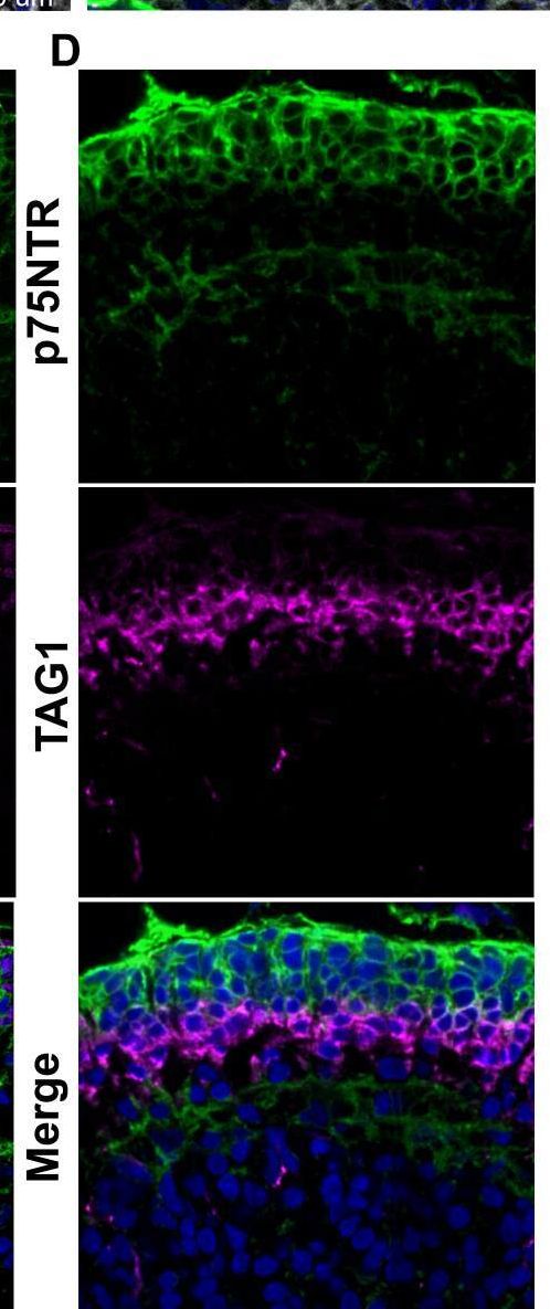 Detection of Contactin-2/TAG1 by Immunohistochemistry