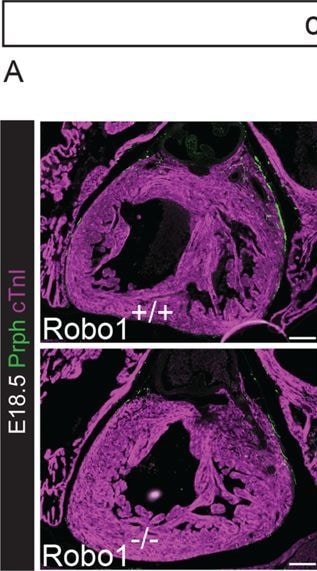 Detection of ROBO1 by Immunohistochemistry