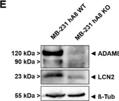 Detection of Human Lipocalin-2/NGAL by Western Blot
