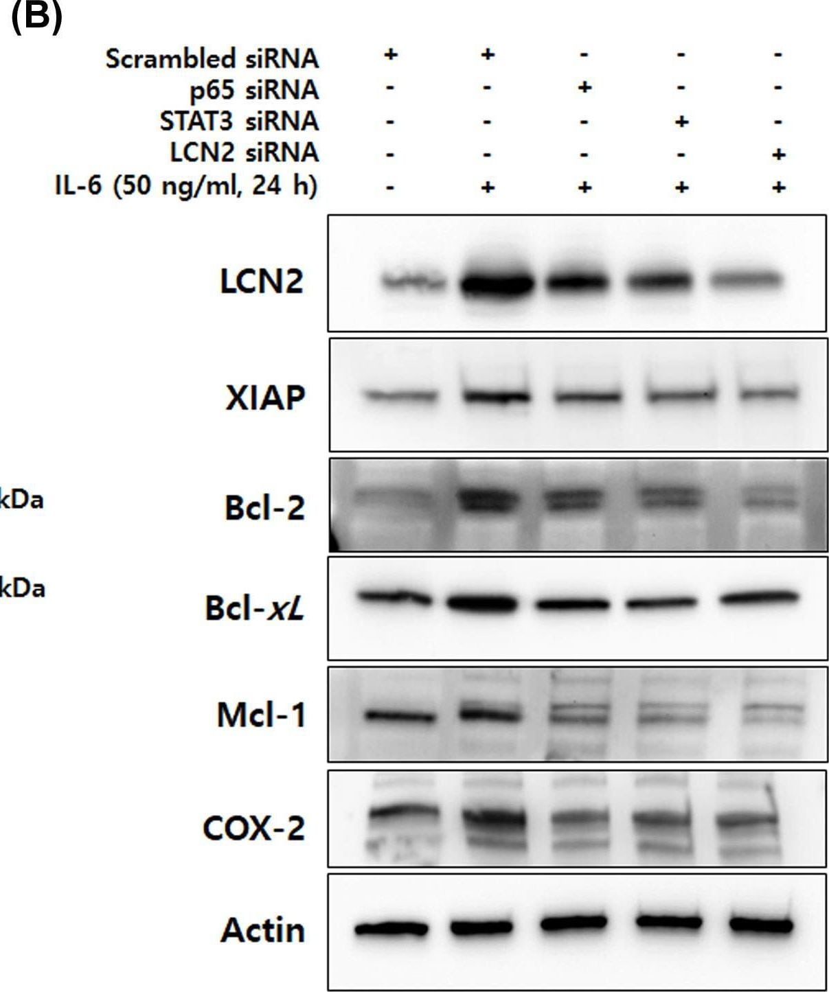 Detection of Lipocalin-2/NGAL by Western Blot