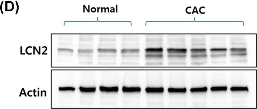 Detection of Lipocalin-2/NGAL by Western Blot