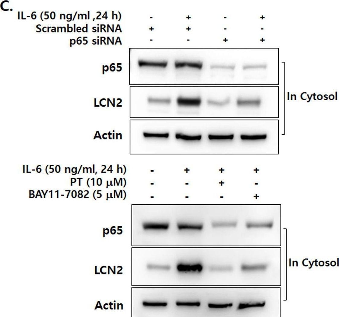 Detection of Lipocalin-2/NGAL by Western Blot