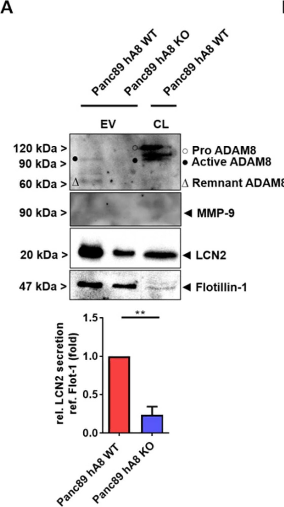 Detection of Human Lipocalin-2/NGAL by Western Blot