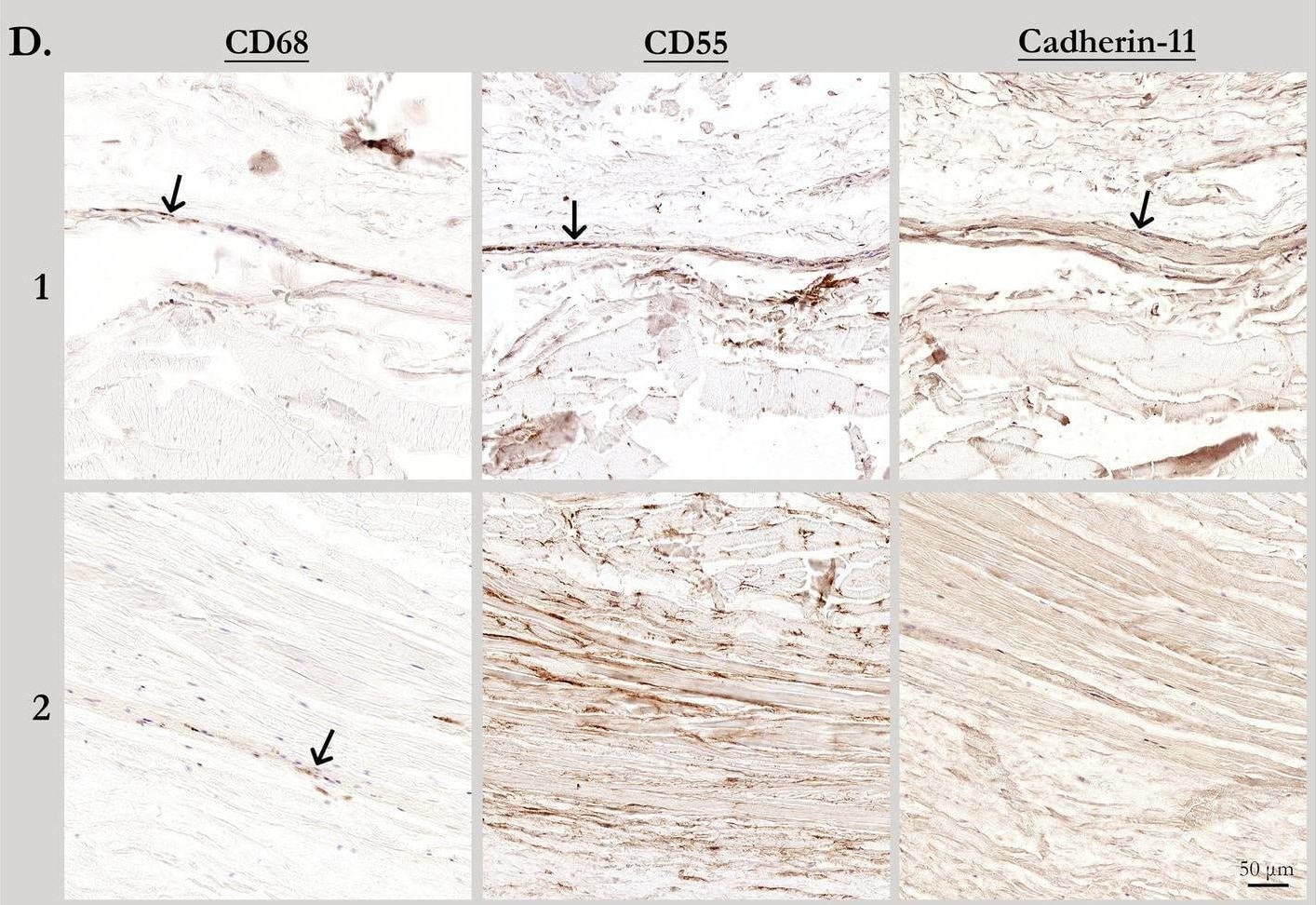 Detection of Cadherin-11 by Immunohistochemistry