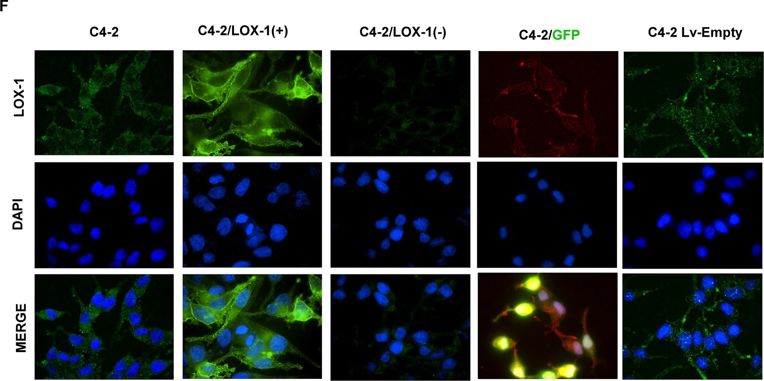 Detection of Human LOX-1/OLR1 by Immunocytochemistry/Immunofluorescence