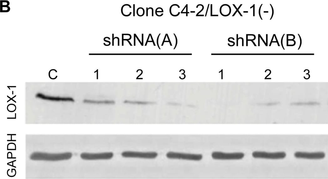 Detection of Human LOX-1/OLR1 by Knockdown Validated